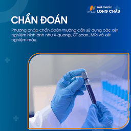 Tiêu xương sọ 5