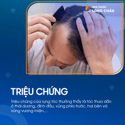 Tóc rụng 2