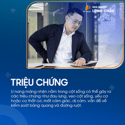 U nang màng nhện não 3