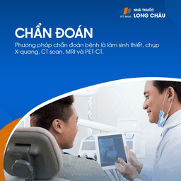 Ung thư tuyến nước bọt 5