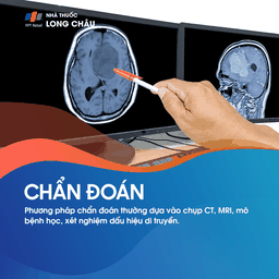 U tế bào thần kinh đệm ít nhánh 5