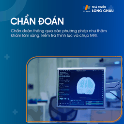 Viêm dây thần kinh tiền đình 5