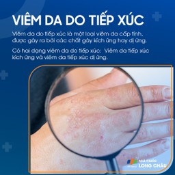 Viêm da do tiếp xúc 1