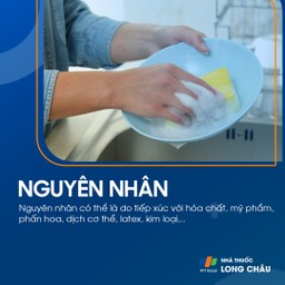 Nguyên nhân viêm da do tiếp xúc do hóa chất, mỹ phẩm và kim loại