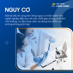 Đối tượng nguy cơ mắc viêm da do tiếp xúc là người có da nhạy cảm và tiếp xúc thường xuyên với hóa chất