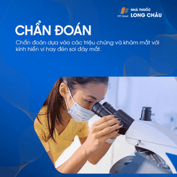 Viêm giác mạc chấm nông 5