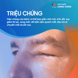 Viêm tổ chức hốc mắt 2