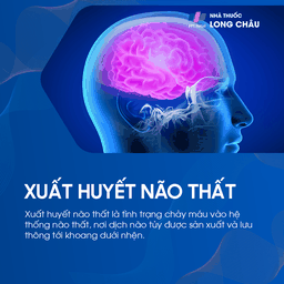 Xuất huyết não thất 1