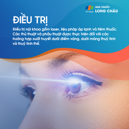 Xuất huyết võng mạc 6