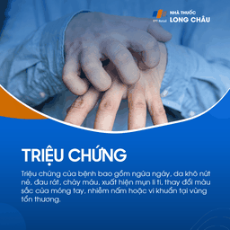 Triệu chứng gồm ngứa ngáy, da khô nứt nẻ, đau rát, chảy máu, mụn li ti, thay đổi màu móng, nhiễm nấm