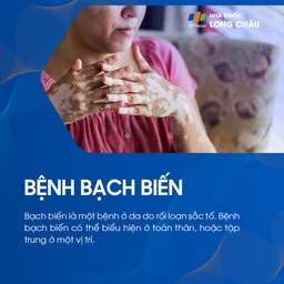 Bạch biến là bệnh da do rối loạn sắc tố, có thể xuất hiện toàn thân hoặc cục bộ