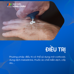 Điều trị bạch biến có thể dùng corticoid, dung dịch meladinine, thuốc ức chế miễn dịch, cấy da