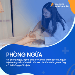 Phòng ngừa bao gồm duy trì độ ẩm cho da, tránh tiếp xúc với các chất gây dị ứng