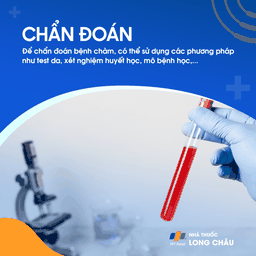 Chẩn đoán chàm dựa trên test da, xét nghiệm máu, mô bệnh học hoặc loại trừ các bệnh lý da khác.