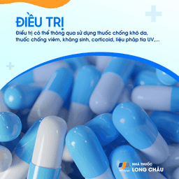 Điều trị chàm bằng thuốc dưỡng ẩm, chống viêm, kháng sinh, corticoid hoặc liệu pháp ánh sáng tùy mức độ bệnh