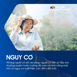 Đối tượng có nguy cơ cao bị đồi mồi thường là phụ nữ trung niên, đặc biệt trong và sau thời kỳ mang thai