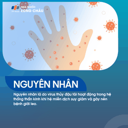 bệnh giời leo, thường liên quan đến sự tái hoạt động của virus varicella-zoster ở người đã từng mắc thủy đậu