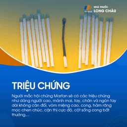 Hội chứng Marfan 2