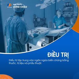 Hội chứng Marfan 5