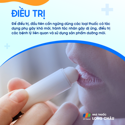 điều trị khô môi hiệu quả bằng cách sử dụng sản phẩm dưỡng ẩm và tránh liếm môi