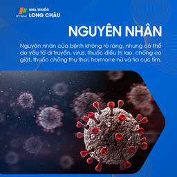 Virus là yếu tố khởi phát lupus ban đỏ