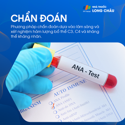 Xét nghiệm ANA Test là phương pháp chẩn đoán lupus ban đỏ