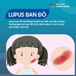 Lupus Ban Đỏ Hệ Thống 1