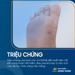 Mụn cóc ở lòng bàn chân – mụn lõm, có chấm đen ở giữa, gây đau khi di chuyển