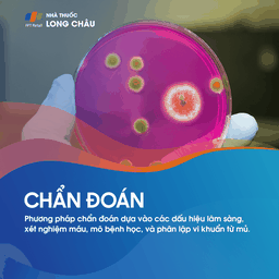 Quá trình chẩn đoán bệnh mụn nhọt bằng cách lấy mẫu từ các nốt mụn để xét nghiệm