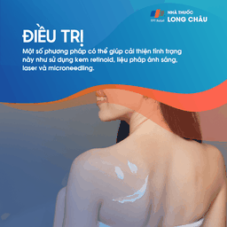 Sử dụng các loại kem và dầu bôi trị rạn da để cải thiện độ đàn hồi của da