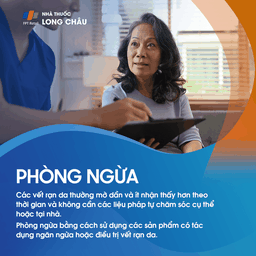 sử dụng kem dưỡng ẩm thường xuyên để phòng ngừa rạn da