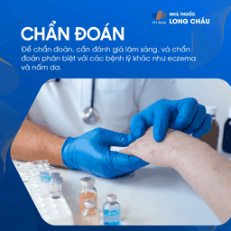 Chẩn đoán bệnh tổ đỉa thông qua khám lâm sàng và có thể yêu cầu làm các xét nghiệm