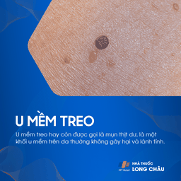 U Mềm Treo 1