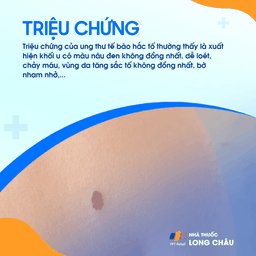 Ung Thư Tế Bào Hắc Tố 2