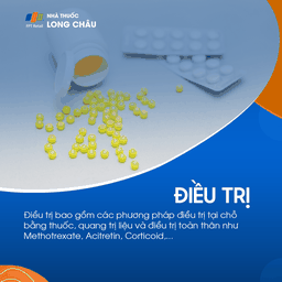 Điều trị vảy nến gồm thuốc bôi, quang trị liệu và thuốc toàn thân như Methotrexate, Acitretin, Corticoid