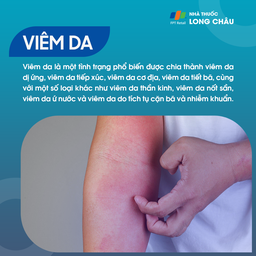 Viêm da: Triệu chứng đỏ, ngứa và phát ban trên da