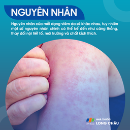 Nguyên nhân gây viêm da như dị ứng, nhiễm trùng