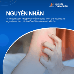 Viêm Mô Tế Bào 3