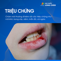 Triệu chứng chàm môi với vết nứt và đỏ trên môi