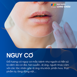 Đối tượng nguy cơ mắc chàm môi là người có da nhạy cảm và dễ bị dị ứng