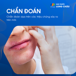 Chẩn đoán chàm môi qua kiểm tra da liễu và tư vấn chuyên gia