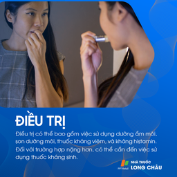 Điều trị chàm môi bằng kem dưỡng ẩm và thuốc bôi chống viêm