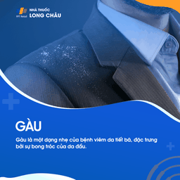 Gàu là một dạng nhẹ của bệnh viêm da tiết bã nhờn không rõ nguyên nhân