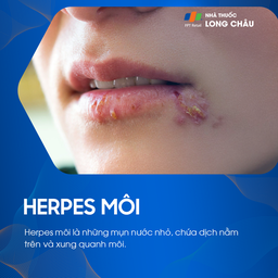 Herpes môi là bệnh gì? Nguyên nhân gây bệnh, cách điều trị và phòng ngừa