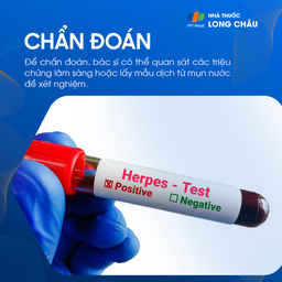 Cách chẩn đoán bệnh Herpes môi