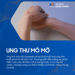 Ung thư mô mỡ 1
