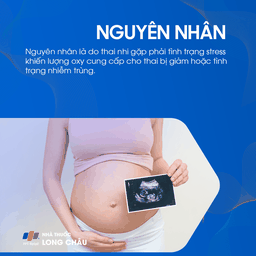 Hội chứng hít phân su 3