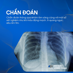 Hội chứng hít phân su 5