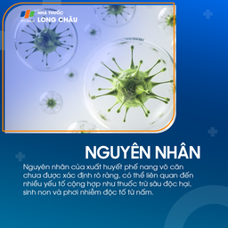 Xuất huyết phế nang vô căn 3