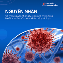 nguyên nhân thường gặp gây sốc bao gồm mất máu, nhiễm trùng nặng, và phản ứng dị ứng nghiêm trọng